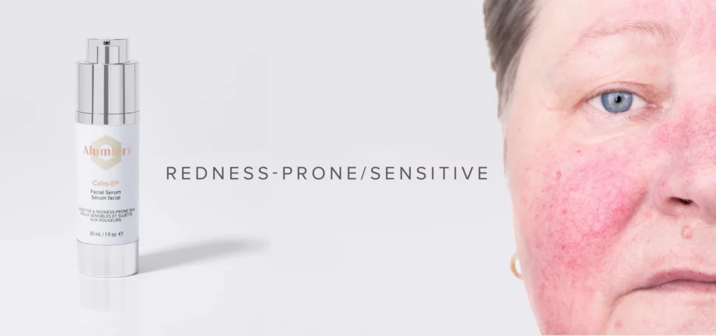 Sensitive-Redness-Prone-facial serum