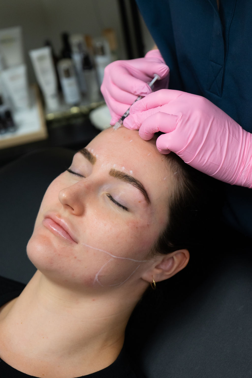 Botox for facial slimming in Vancouver