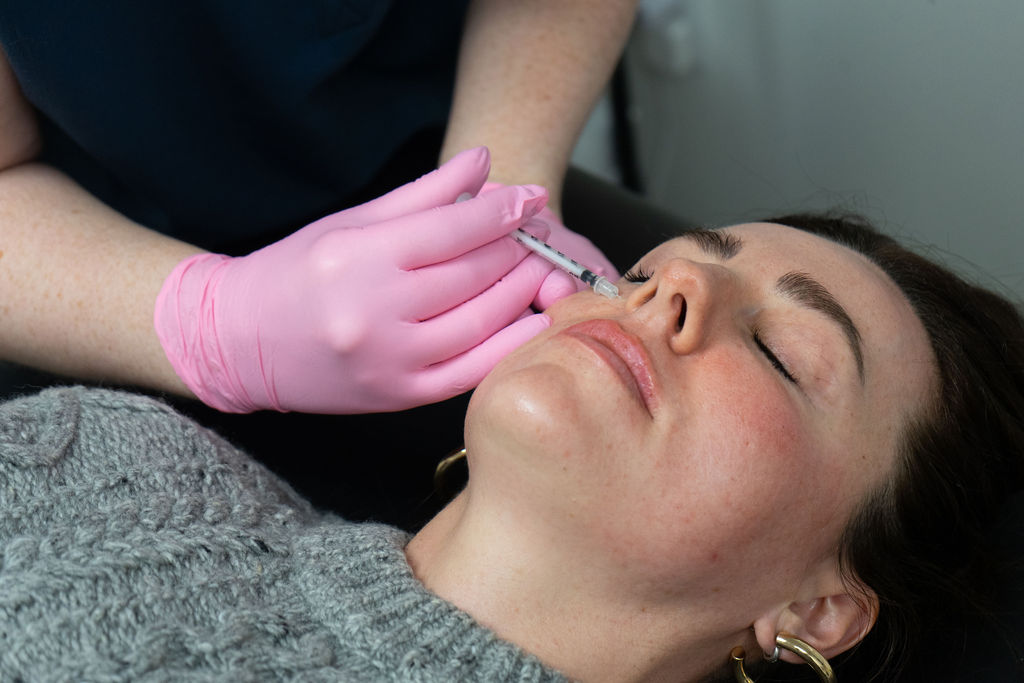 Botox for nostril flares in Vancouver